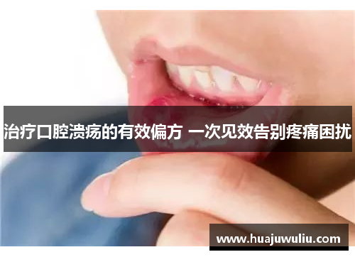 治疗口腔溃疡的有效偏方 一次见效告别疼痛困扰